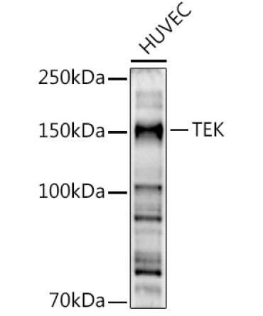 TEK Rabbit Polyclonal Antibody