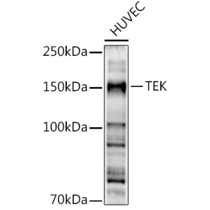 TEK Rabbit Polyclonal Antibody