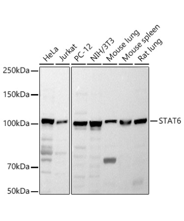 STAT6 Rabbit Polyclonal Antibody