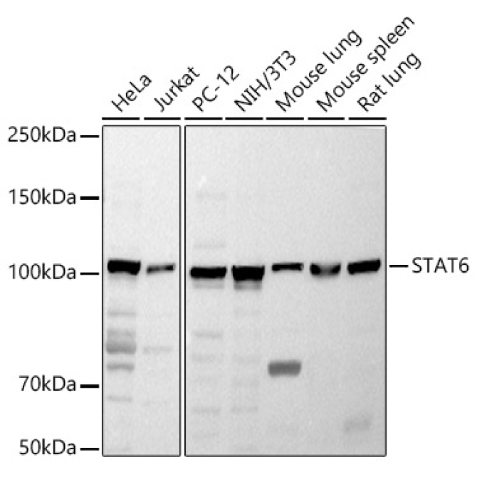 STAT6 Rabbit Polyclonal Antibody