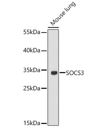 SOCS3 Rabbit Polyclonal Antibody