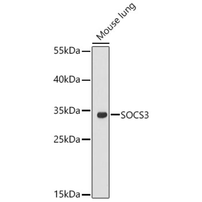 SOCS3 Rabbit Polyclonal Antibody