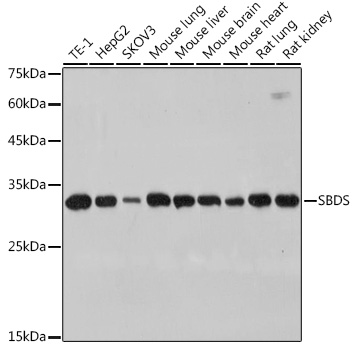 SBDS Rabbit Monoclonal Antibody