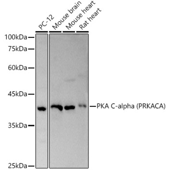 PKA C-alpha (PRKACA) Rabbit Polyclonal Antibody