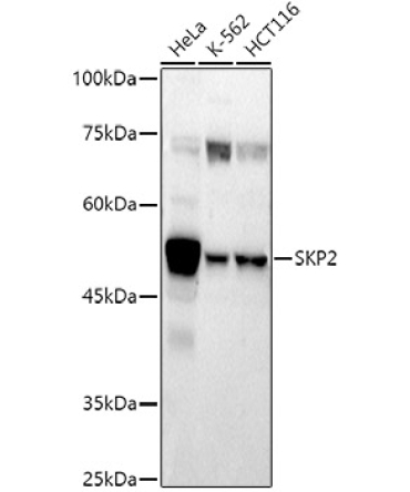 SKP2 Rabbit Polyclonal Antibody