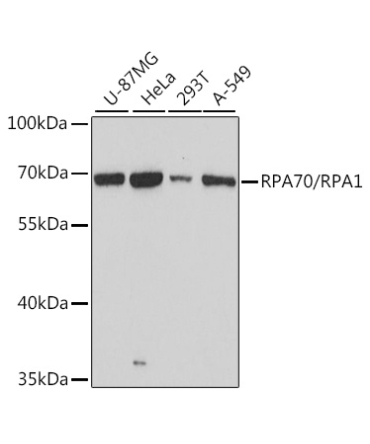 RPA70/RPA1 Rabbit Polyclonal Antibody