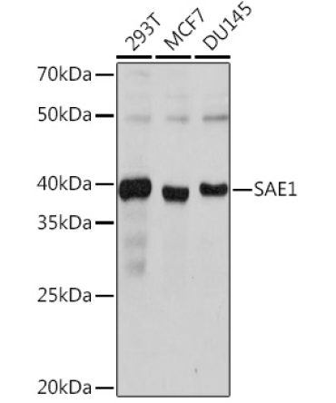 SAE1 Rabbit Monoclonal Antibody