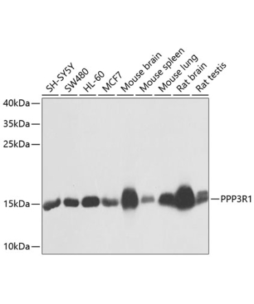 PPP3R1 Rabbit Polyclonal Antibody