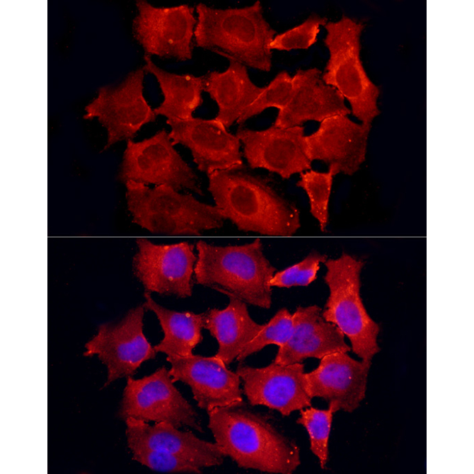 TRAF6 Rabbit Polyclonal Antibody