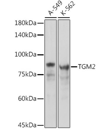Transglutaminase 2 (TGM2) Rabbit Polyclonal Antibody