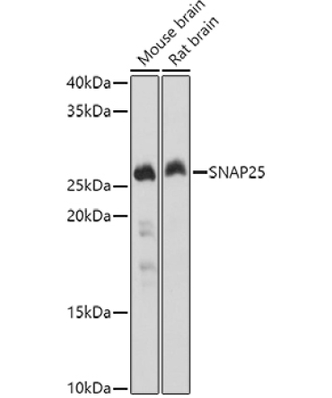 SNAP25 Rabbit Polyclonal Antibody