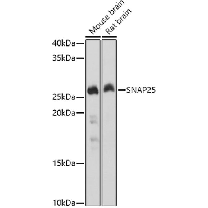 SNAP25 Rabbit Polyclonal Antibody