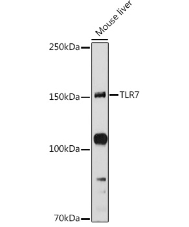 TLR7 Rabbit Polyclonal Antibody