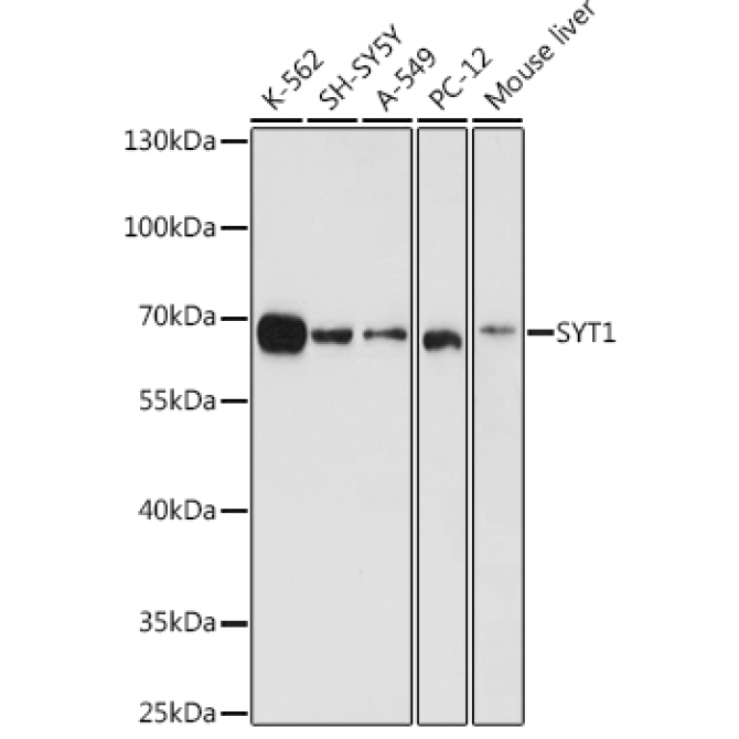 SYT1 Rabbit Polyclonal Antibody