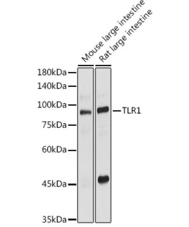 TLR1 Rabbit Polyclonal Antibody