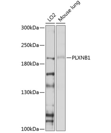PLXNB1 Rabbit Polyclonal Antibody