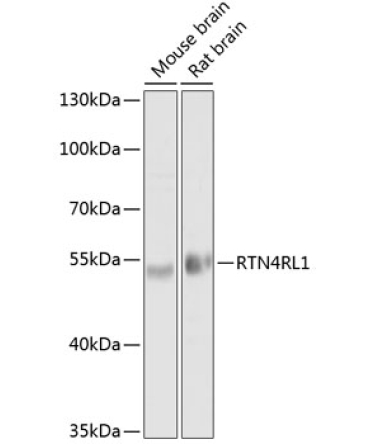 RTN4RL1 Rabbit Polyclonal Antibody