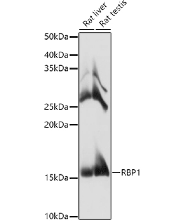 RBP1 Rabbit Polyclonal Antibody
