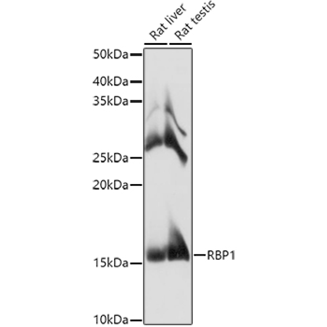 RBP1 Rabbit Polyclonal Antibody