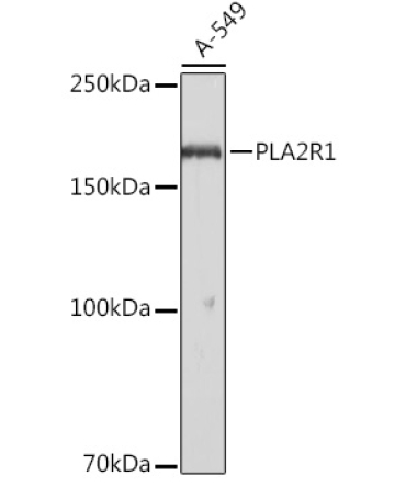 PLA2R1 Rabbit Polyclonal Antibody