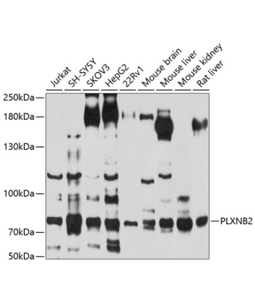PLXNB2 Rabbit Polyclonal Antibody