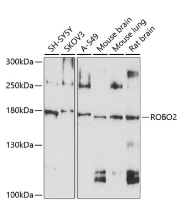 ROBO2 Rabbit Polyclonal Antibody