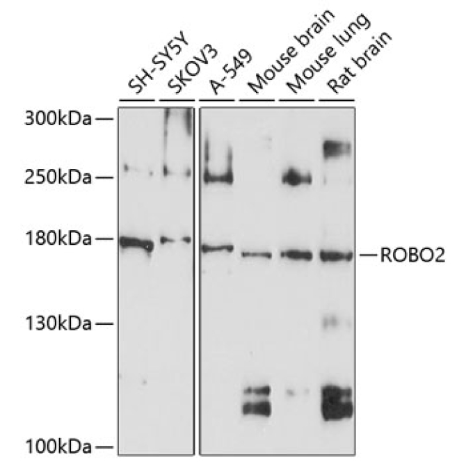 ROBO2 Rabbit Polyclonal Antibody