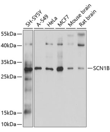 SCN1B Rabbit Polyclonal Antibody