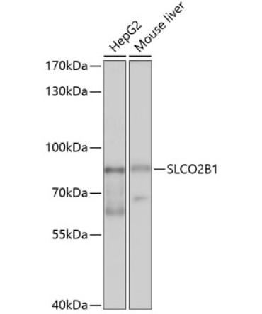SLCO2B1 Rabbit Polyclonal Antibody