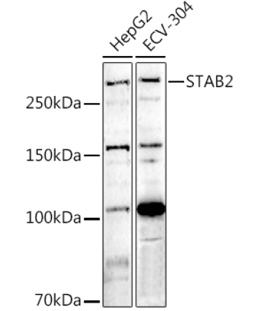 STAB2 Rabbit Polyclonal Antibody