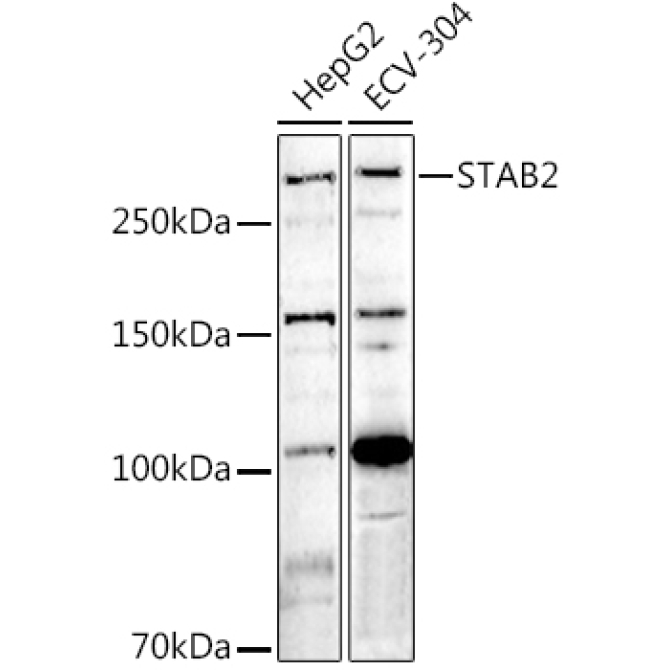 STAB2 Rabbit Polyclonal Antibody