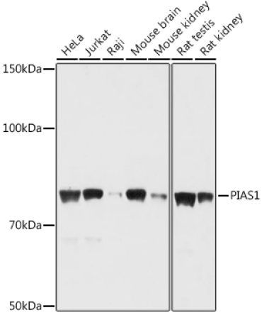 PIAS1 Rabbit Polyclonal Antibody