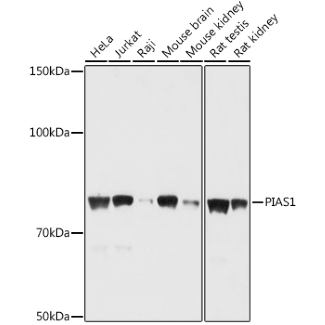 PIAS1 Rabbit Polyclonal Antibody