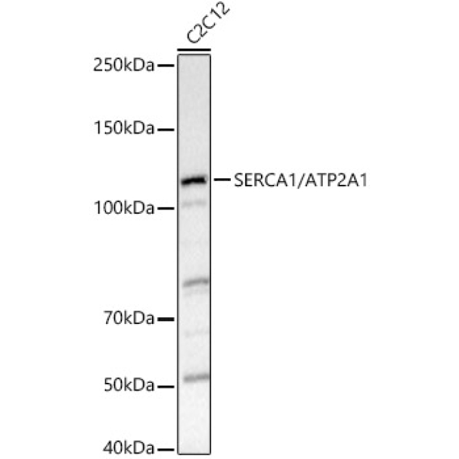 SERCA1/ATP2A1 Rabbit Polyclonal Antibody