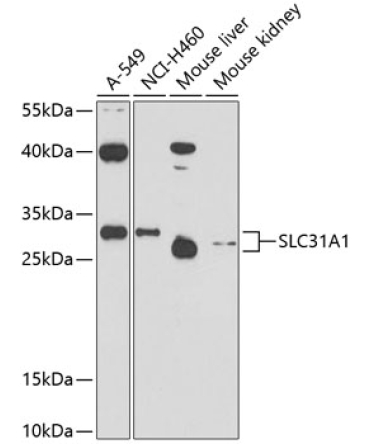 SLC31A1 Rabbit Polyclonal Antibody
