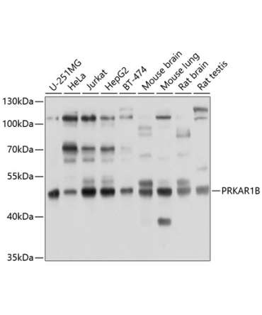PRKAR1B Rabbit Polyclonal Antibody