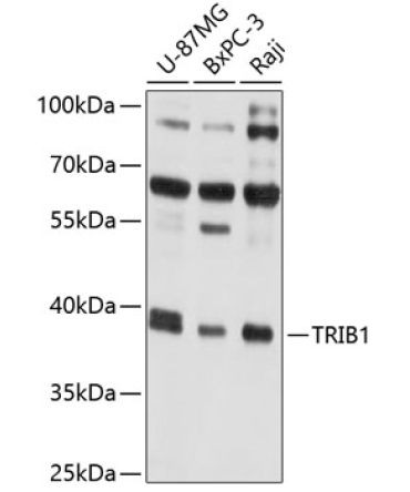 TRIB1 Rabbit Polyclonal Antibody