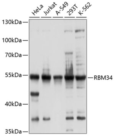 RBM34 Rabbit Polyclonal Antibody