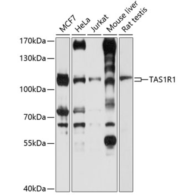 TAS1R1 Rabbit Polyclonal Antibody