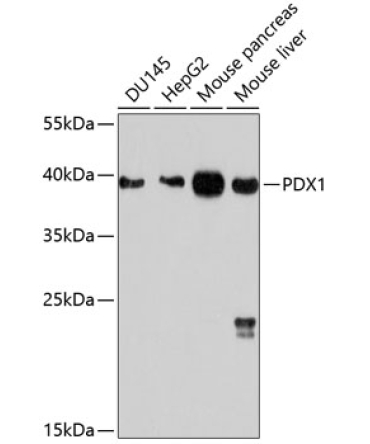 PDX1 Rabbit Polyclonal Antibody
