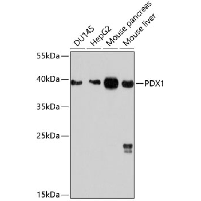 PDX1 Rabbit Polyclonal Antibody