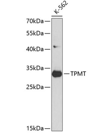 TPMT Rabbit Polyclonal Antibody