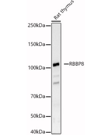 RBBP8 Rabbit Polyclonal Antibody