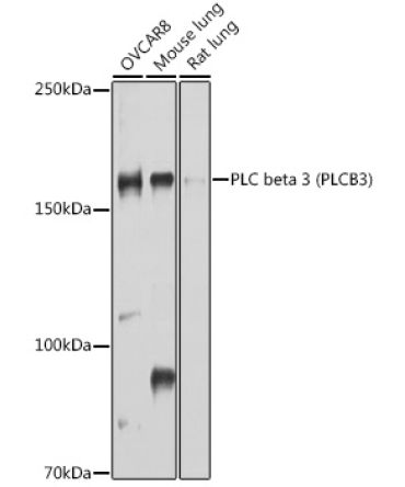 PLC beta 3 (PLCB3) Rabbit Polyclonal Antibody