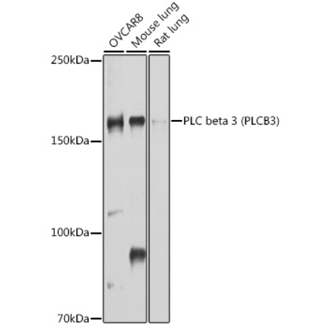 PLC beta 3 (PLCB3) Rabbit Polyclonal Antibody