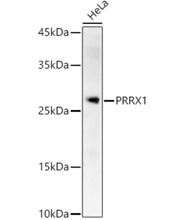 PRRX1 Rabbit Polyclonal Antibody