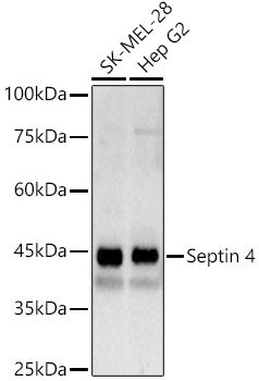 Septin 4 Rabbit Polyclonal Antibody
