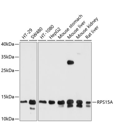 RPS15A Rabbit Polyclonal Antibody