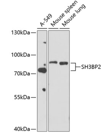 SH3BP2 Rabbit Polyclonal Antibody