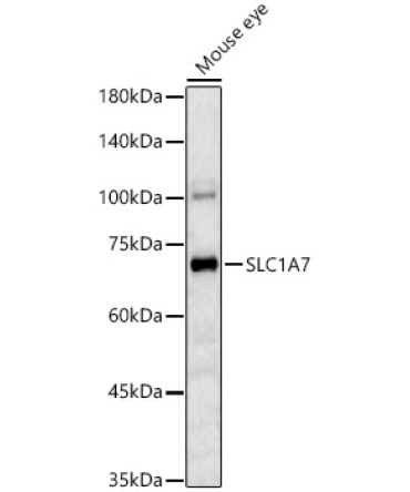 SLC1A7 Rabbit Polyclonal Antibody